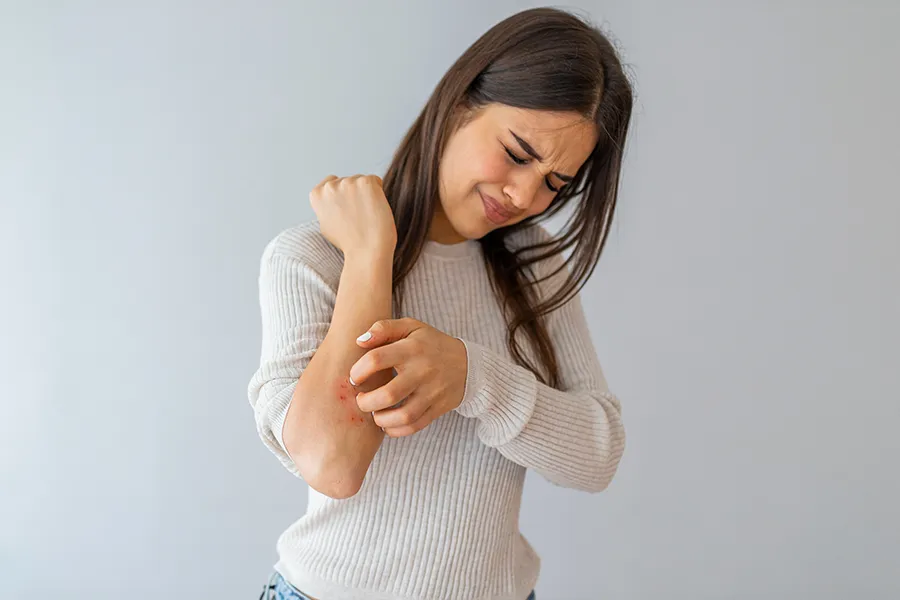 Eczema-Clinic A young brunette woman scratches her forearm and winces in discomfort. Get treatment for eczema from Dr. Noelani Rodriguez in San Diego.