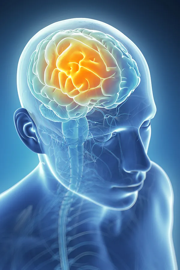 Migraine-Treatment 3D illustration of the brain with glowing pain center. Dr. Noelani Rodriguez treats migraines using functional medicine in San Diego.