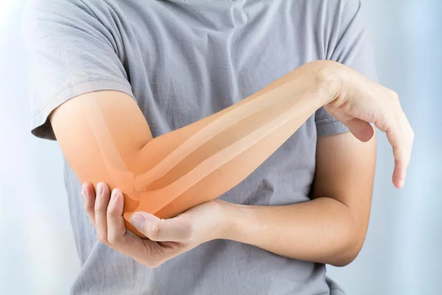 Osteoporosis-Doctor A close-up of a woman holding her elbow with an illustration of the bones and joint experiencing pain from osteoporosis. Get osteoporosis treatment from Dr. Noelani Rodriguez in San Diego.