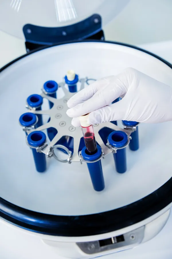 PRP-Platelet-Rich-Plasma-Treatment A centrifuge with vials of plasma in a medical lab, representing Platelet Rich Plasma, or PRP, therapy from Dr. Noelani Rodriguez in San Diego.