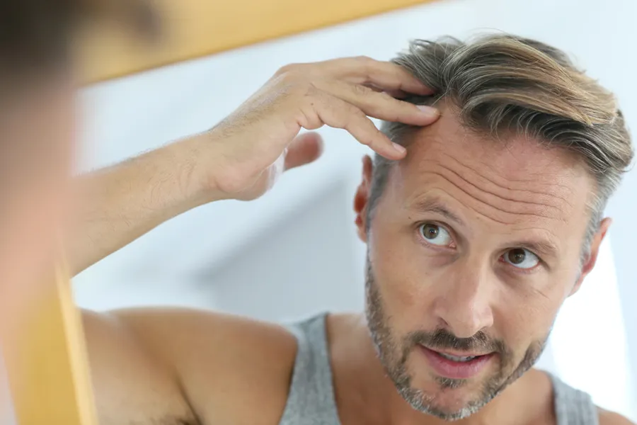 Peptides-for-Hair-Restoration-Doctor A middle-aged man with blonde and gray hair inspects his receding hairline in the mirror, considering getting peptides for hair restoration treatments from Dr. Noelani Rodriguez in San Diego.