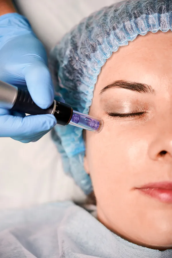 Peptides-for-Skin-and-Aesthetics-Treatment A woman receiving peptide therapy to her face. Get peptides for Skin and Aesthetics from Dr. Noelani Rodriguez in San Diego.