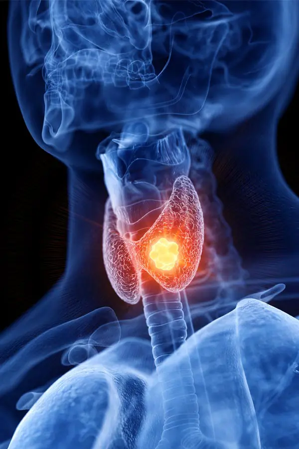Thyroid-Imbalance-Treatment A 3D illustration of an x-ray of a human neck, highlighting the thyroid. Get help with thyroid imbalance from Dr. Noelani Rodriguez in San Diego.